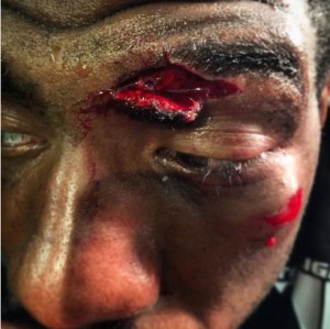 Ron Stallings cut Courtsey of UFC Shanda