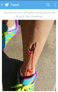 Bec Rawlings 'Gash' picture ** Warning Grapic** 